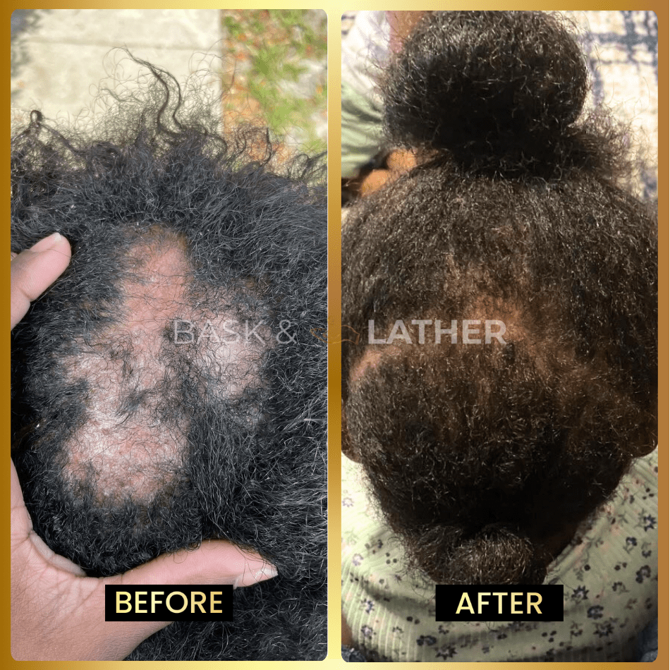 XL Growth & Style Bundle + Free Edge Brush