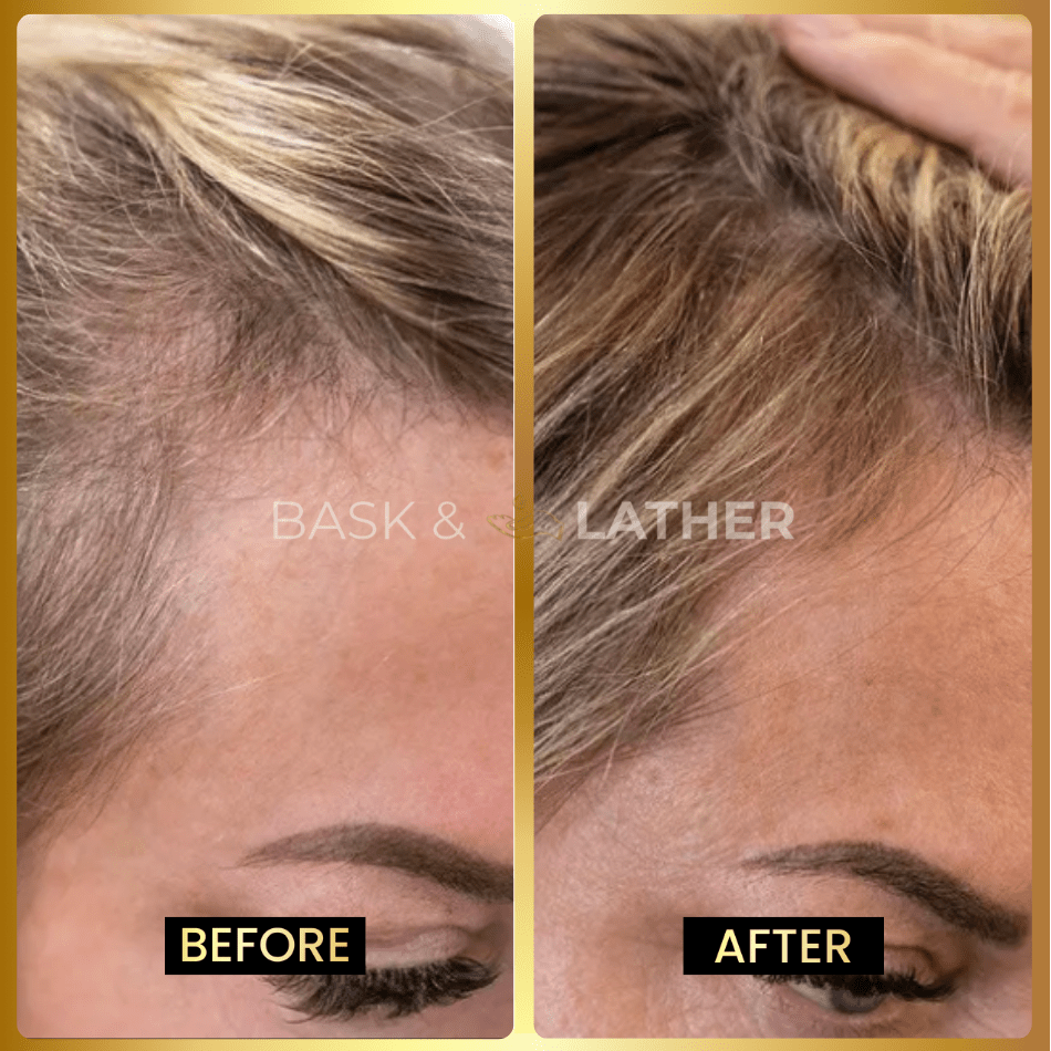 Growth & Length Retention Bundle