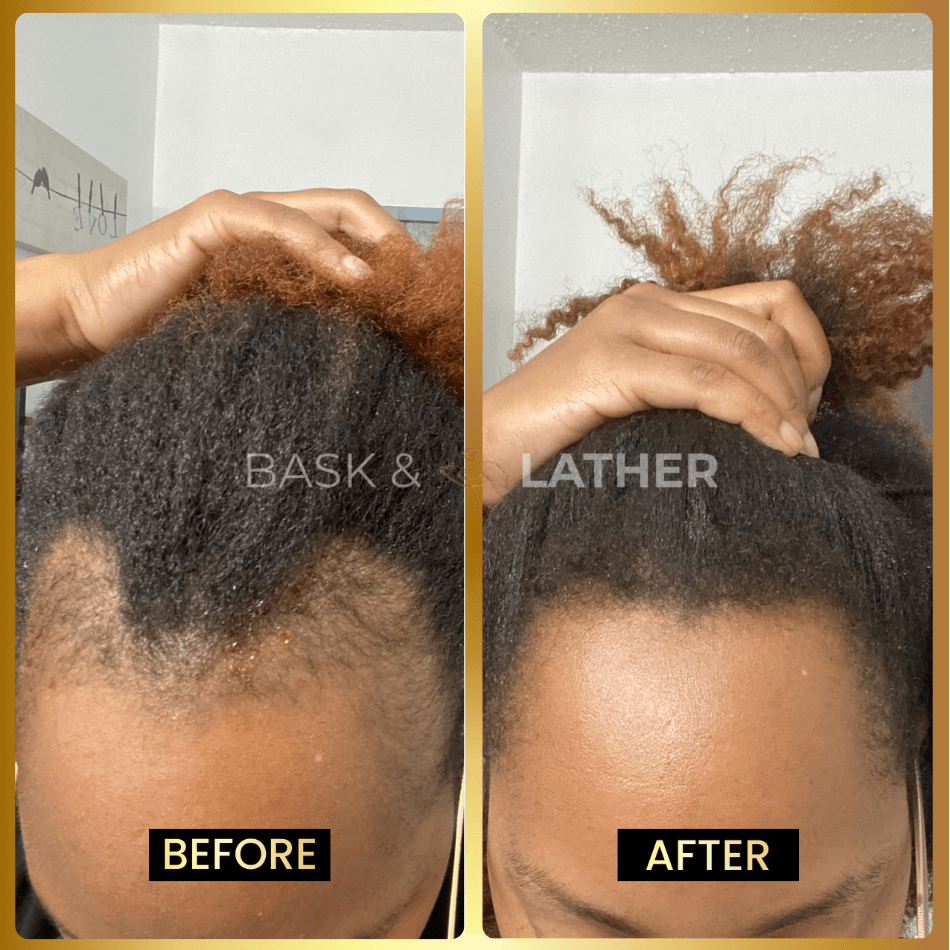 JUMBO Scalp Stimulator