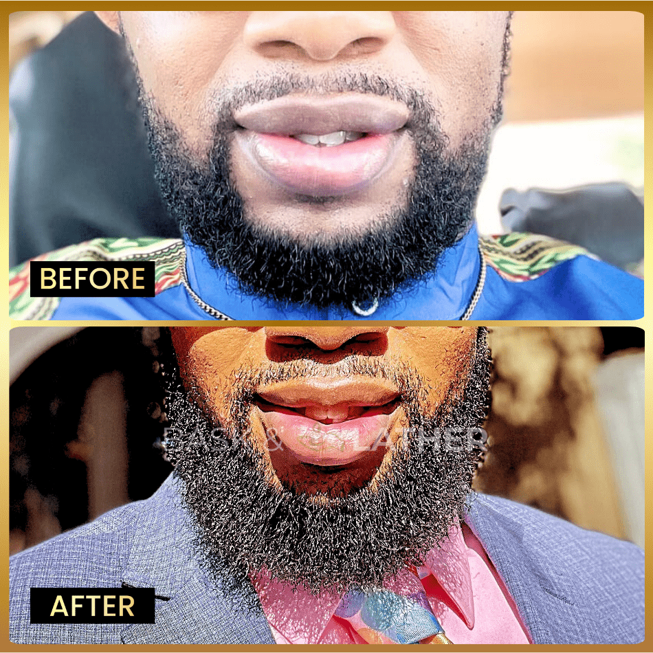 Beard Oil ? Beard Softener & Growth Enhancer
