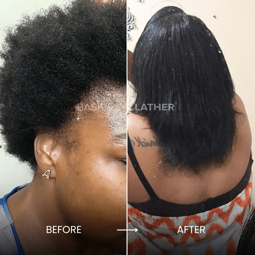 XL Cleanse and Growth Bundle - For Moisture & Hydration