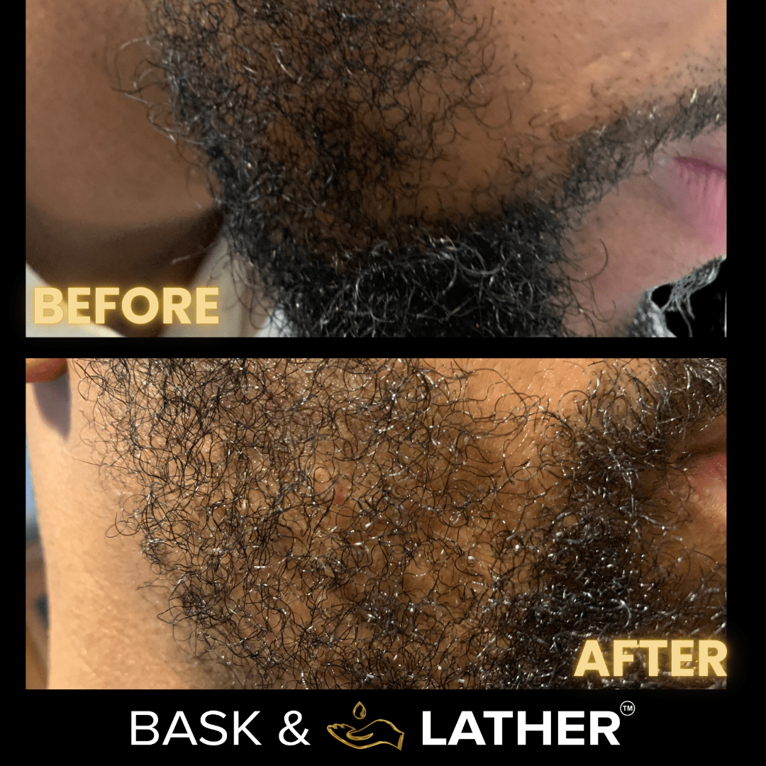 Men?s Healthy Hair and Beard Starter Kit
